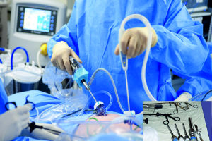 Лапароскопическая хирургия