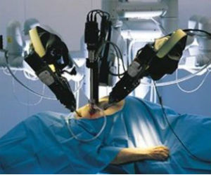 Хирургия с роботом Да Винчи