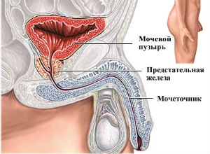 Простатэктомия (удаление предстательной железы)